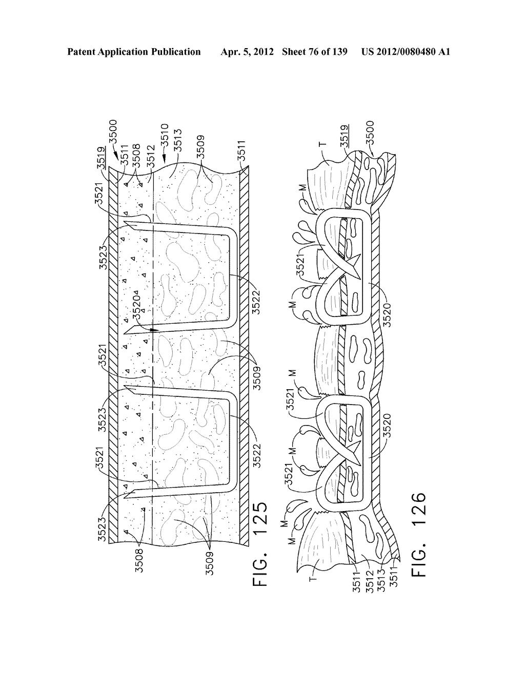 FASTENER SYSTEM COMPRISING A PLURALITY OF CONNECTED RETENTION MATRIX     ELEMENTS - diagram, schematic, and image 77