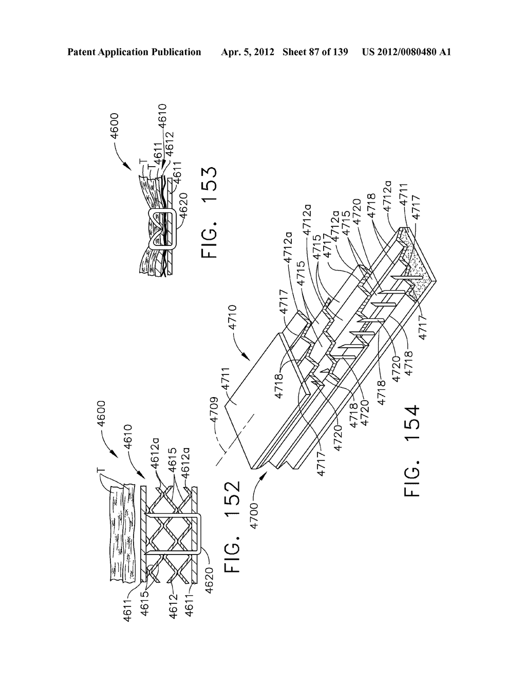 FASTENER SYSTEM COMPRISING A PLURALITY OF CONNECTED RETENTION MATRIX     ELEMENTS - diagram, schematic, and image 88