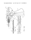 IMPLANTABLE FASTENER CARTRIDGE HAVING A NON-UNIFORM ARRANGEMENT diagram and image