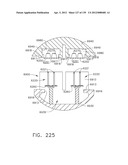 IMPLANTABLE FASTENER CARTRIDGE HAVING A NON-UNIFORM ARRANGEMENT diagram and image