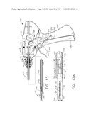 IMPLANTABLE FASTENER CARTRIDGE HAVING A NON-UNIFORM ARRANGEMENT diagram and image