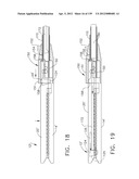 IMPLANTABLE FASTENER CARTRIDGE HAVING A NON-UNIFORM ARRANGEMENT diagram and image