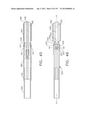 IMPLANTABLE FASTENER CARTRIDGE HAVING A NON-UNIFORM ARRANGEMENT diagram and image