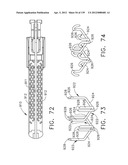 IMPLANTABLE FASTENER CARTRIDGE HAVING A NON-UNIFORM ARRANGEMENT diagram and image