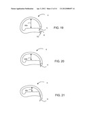 Feeder Belt and Staples for Surgical Stapler diagram and image