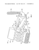 RESTRAINT DEVICE FOR A TIRE diagram and image