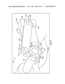 RESTRAINT DEVICE FOR A TIRE diagram and image