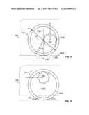 RESTRAINT DEVICE FOR A TIRE diagram and image