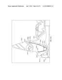 RESTRAINT DEVICE FOR A TIRE diagram and image