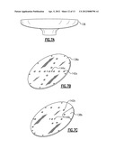 APPARATUS AND METHOD FOR UNIFORM METAL PLATING diagram and image