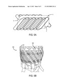 SKEWED RADIO FREQUENCY COIL ARRAYS FOR MAGNETIC RESONANCE IMAGING diagram and image