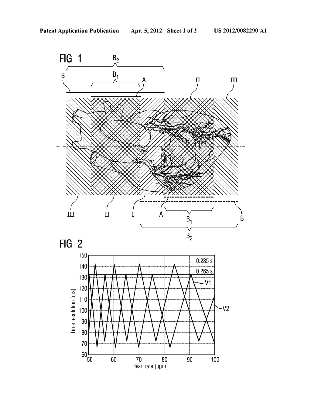 Method For Scanning A Heart With A Dual-Source CT Device And Embodiment Of     A Dual-Source CT Device - diagram, schematic, and image 02