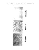 Neovascular-Targeted Immunoconjugates diagram and image