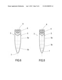 METHOD FOR EXPANDING BONE CREST AND AN IMPLANT-EXPANDER FOR USE IN SAID     METHOD diagram and image