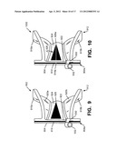 Putter Heads and Putters diagram and image