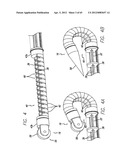 Remote Tissue Retraction Device diagram and image