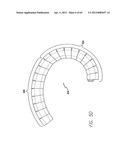 Remote Tissue Retraction Device diagram and image