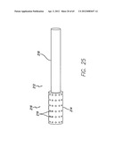 Remote Tissue Retraction Device diagram and image