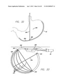 Remote Tissue Retraction Device diagram and image