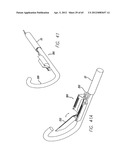 Remote Tissue Retraction Device diagram and image