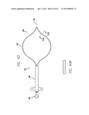 Remote Tissue Retraction Device diagram and image