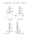 Remote Tissue Retraction Device diagram and image