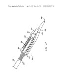 Remote Tissue Retraction Device diagram and image