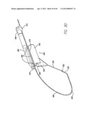 Remote Tissue Retraction Device diagram and image