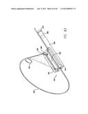 Remote Tissue Retraction Device diagram and image