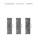 Retrospectively Correlated Turbo Spin Echo Imaging diagram and image