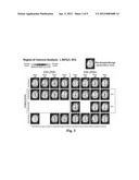 HEAD INJURY DIAGNOSTICS diagram and image