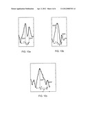 IMPLANTABLE CORONARY PERFUSION MONITORING DEVICE diagram and image