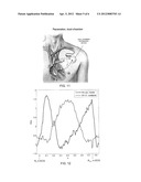 IMPLANTABLE CORONARY PERFUSION MONITORING DEVICE diagram and image