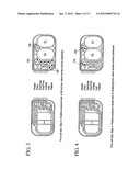 Peritoneal dialysis machine diagram and image