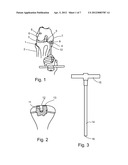 IMPLEMENT FOR ORIENTATING A TOOL, PARTICULARLY USEFUL IN SURGICAL TOOLS     FOR HARVESTING AND IMPLANTING BONE PLUGS TO REPAIR DAMAGED BONE TISSUE diagram and image