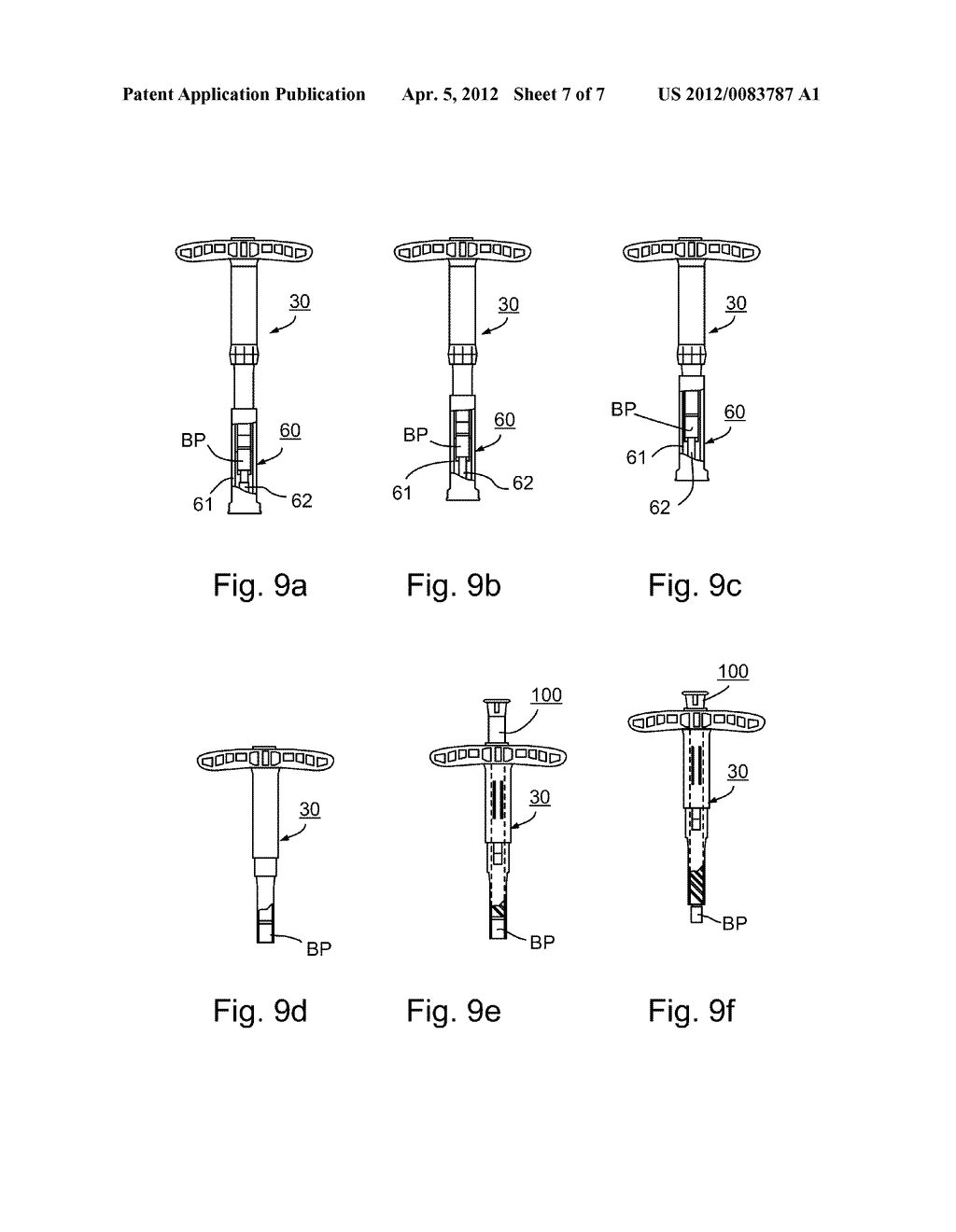 IMPLEMENT FOR ORIENTATING A TOOL, PARTICULARLY USEFUL IN SURGICAL TOOLS     FOR HARVESTING AND IMPLANTING BONE PLUGS TO REPAIR DAMAGED BONE TISSUE - diagram, schematic, and image 08