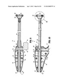 SURGICAL RETRIEVAL APPARATUS diagram and image