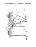 SURGICAL RETRIEVAL APPARATUS diagram and image