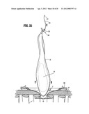 SURGICAL RETRIEVAL APPARATUS diagram and image