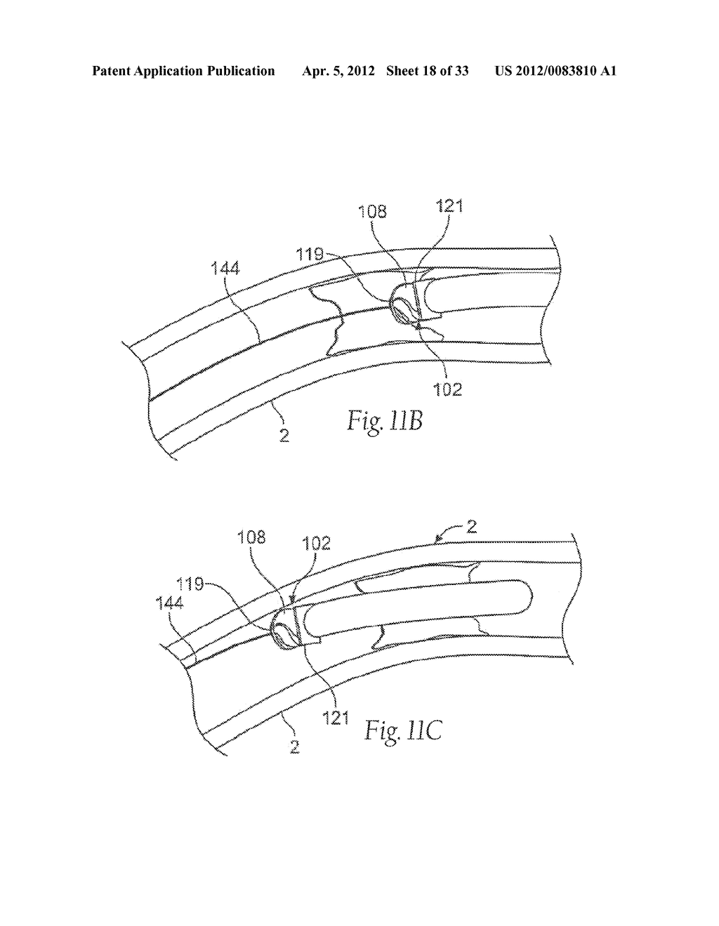 ATHERECTOMY DEVICES AND METHODS - diagram, schematic, and image 19