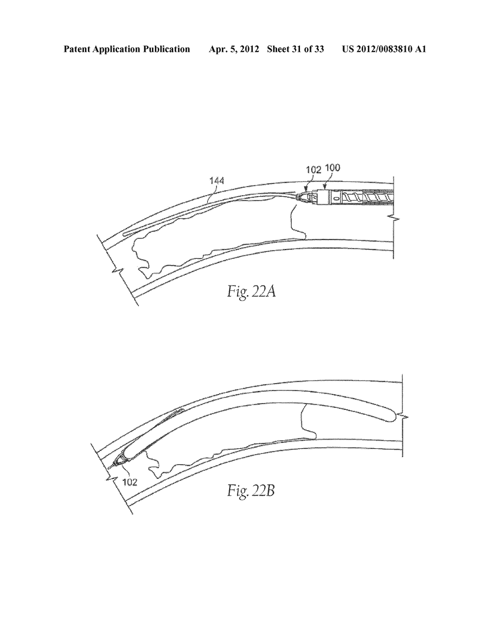 ATHERECTOMY DEVICES AND METHODS - diagram, schematic, and image 32