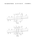 APPARATUS AND METHODS FOR SEALING VASCULAR PUNCTURES diagram and image