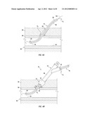 APPARATUS AND METHODS FOR SEALING VASCULAR PUNCTURES diagram and image