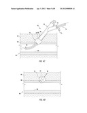 APPARATUS AND METHODS FOR SEALING VASCULAR PUNCTURES diagram and image