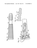 FASTENER WITH SERRATED THREAD FOR ATTACHMENT TO A BONE PLATE AT A     SELECTABLE ANGLE diagram and image