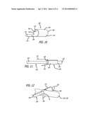 SYSTEM AND METHOD FOR FACILITATING REPAIR AND REATTACHMENT OF COMMINUTED     BONE PORTIONS diagram and image