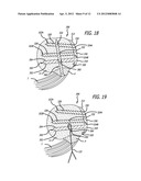 SYSTEM AND METHOD FOR FACILITATING REPAIR AND REATTACHMENT OF COMMINUTED     BONE PORTIONS diagram and image