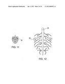 DEVICE AND METHOD FOR TACKING PLAQUE TO A BLOOD VESSEL WALL diagram and image