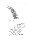 DEVICE AND METHOD FOR TACKING PLAQUE TO A BLOOD VESSEL WALL diagram and image