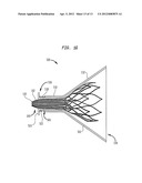 ASSEMBLY AND METHOD FOR LOADING A SELF-EXPANDING COLLAPSIBLE HEART VALVE diagram and image